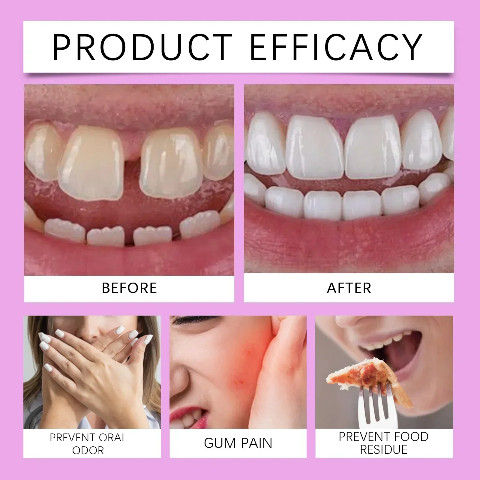 치과 Thermoplastic Denture Adhesive &cushion Reduce Gum Pain Caused Friction Fixed Dentures Enhance Comfort Denture Care Products