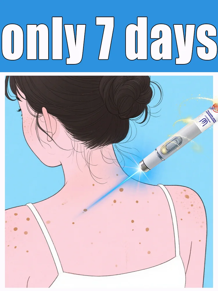 

Generation-2 laser says goodbye to all warts in 7 days