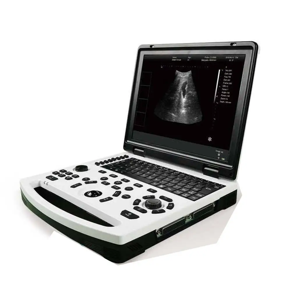 

Automatic High Effective Portable Ultrasound With 12.1 inch HD LED LCD screen For human and Animal