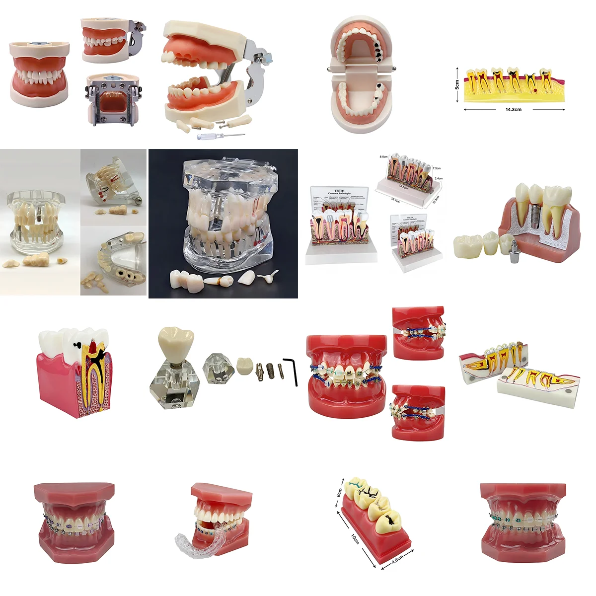 

Dental Teaching Model for Doctor-patient Communication, Oral Teaching Model, Orthodontic Implant Repair and Preparation