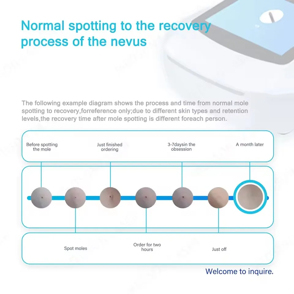 

Аппарат для уменьшения жира и лифтинга лица Aristorm S-образной формы 30K