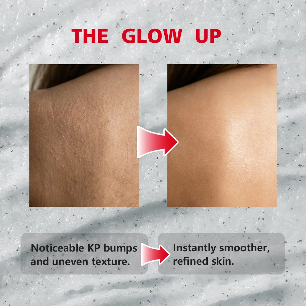 Thumbnail 3 - #29 Best Scrubs Treatments to Buy In 2026