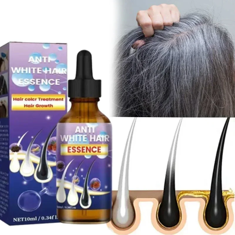 

Serum perawatan rambut abu-abu produk nutrisi perbaikan warna alami putih ke Hitam Perawatan Rambut rontok Pria Wanita