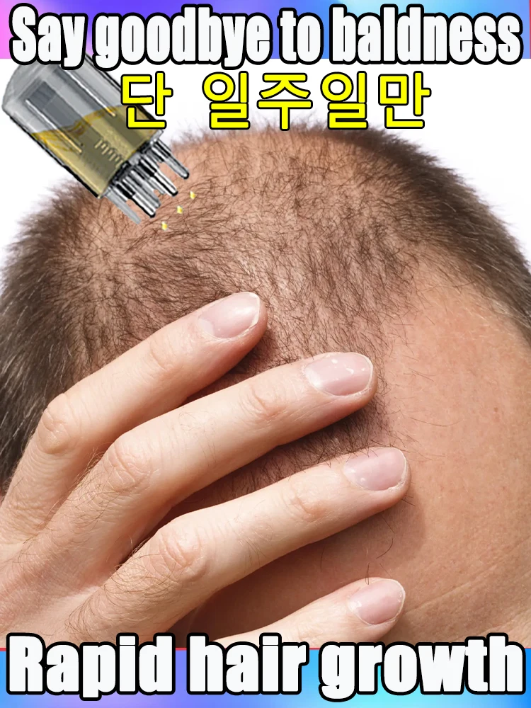 

Scalp Applicator Hair Growth