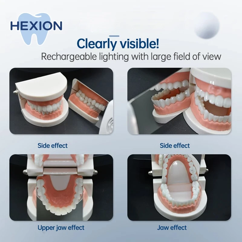 กระจกตรวจฟันเหล็กกล้าความแข็งแรงสูง HEXION - ป้องกันฝ้า - สามารถนึ่งฆ่าเชื้อได้ - สะท้อนแสงภายในช่องปาก - อุปกรณ์ถ่ายภาพฟันแบบอุ้งฟัน/ด้านหลังฟัน