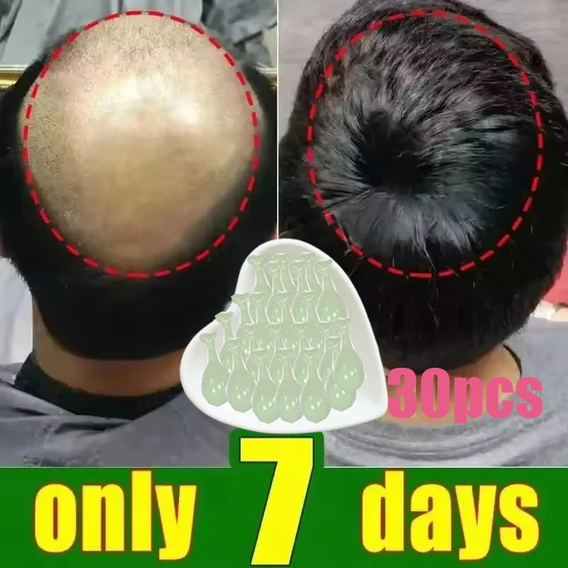 

Hair Growth Essential Oil Rosemary Hair Serum Capsule Oil Anti Hair loss Baldness Repair Damaged Scalp Treatment For Women Men