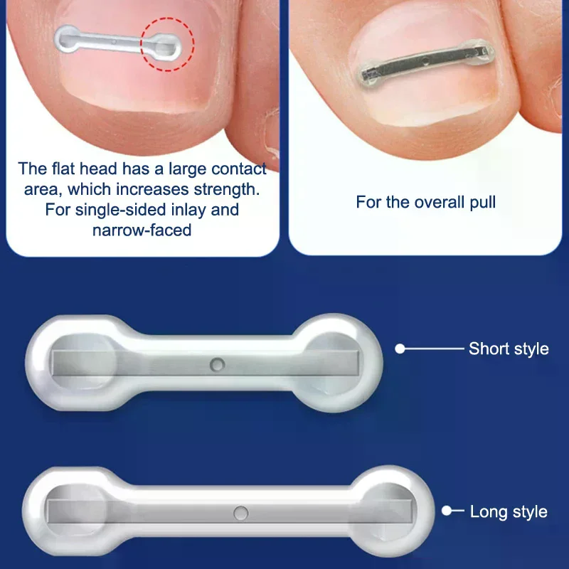 Kit de traitement des ongles incarnés, 12 pièces, avec 4 tailles multiples, outils correcteurs d'ongles incarnés en alliage de titane pour correcteur d'ongles incurvés