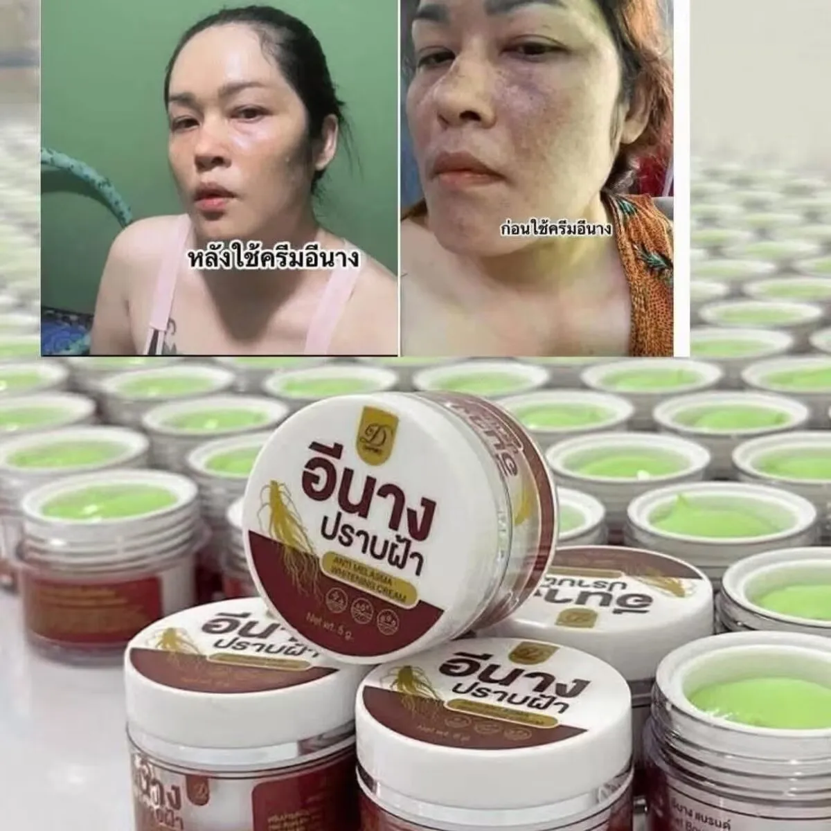 タイのそばかすクリーム、黒ずみ修正、年齢によるシミを薄くする、日焼けによるシミ軽減、顔用保湿剤、肌のトーンを明るくする、均一な肌色へ