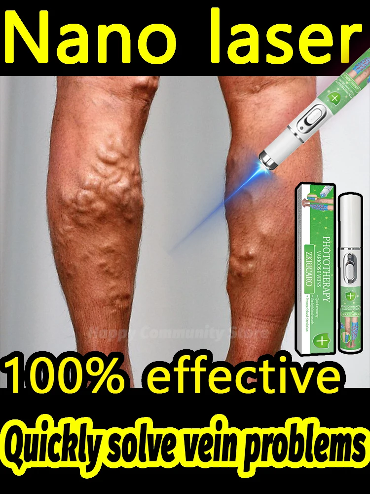 

Technology helps solve ᴠᴀʀɪᴄᴏsᴇ ᴠᴇɪɴ problems