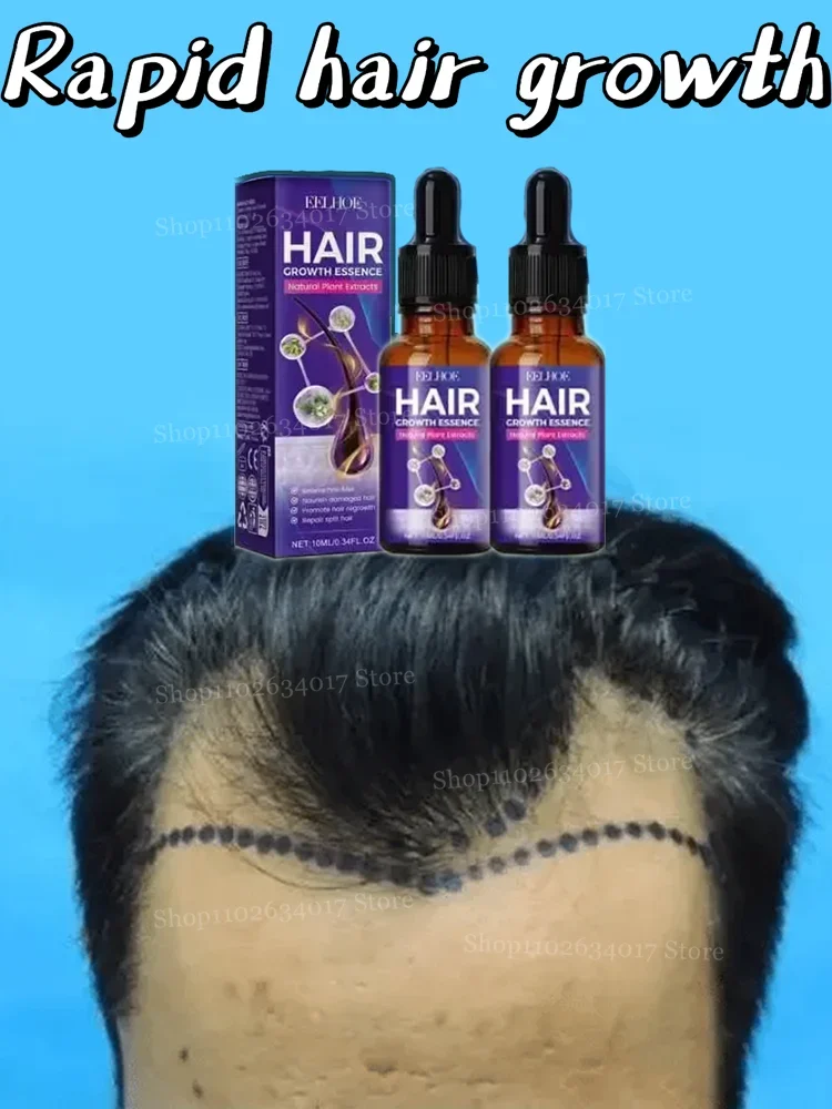 

Bid Farewell to Hair Loss, Hello to Lush Locks