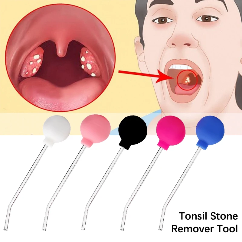 

Tonsil Stone Remover Tool Manual Style Remover Mouth Cleaning Care Tool Ear Wax Tonsil Stone Remover Cleaning Tool Random Color