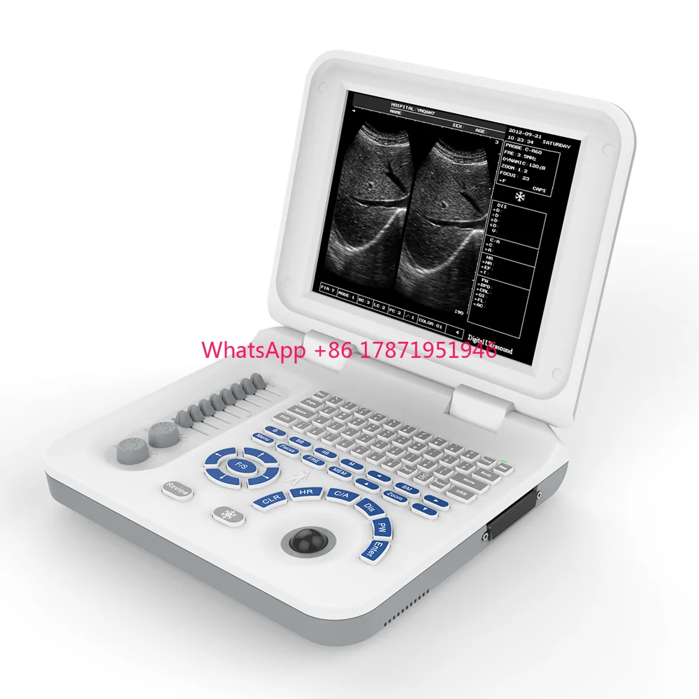 12 inch Portable B/W Ultrasound  Laptop Black and White Ultrasound for Hospital