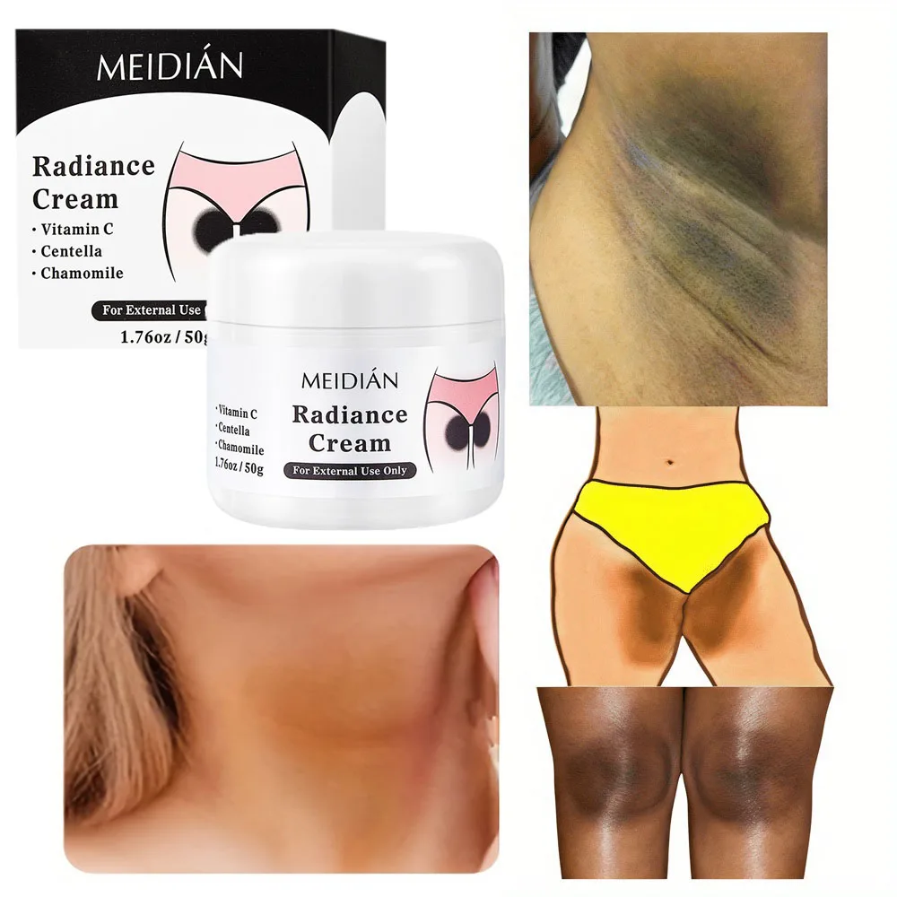 

Отбеливающий крем для тела, быстрое отбеливание, интимные места, осветление подмышек, бедер, внутренние колени, интимные зоны, меланин, уход за кожей, красота, здоровье