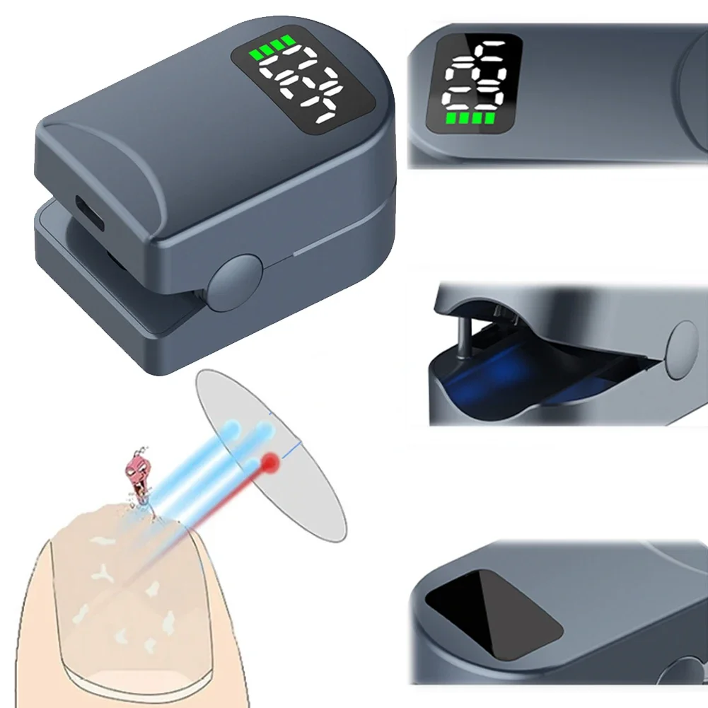 Dispositif de lumière fongique pour ongles, dissolvant fongique décoloré, lumière bleue 460nm + lumière infrarouge 905nm pour ongles épais et ongles