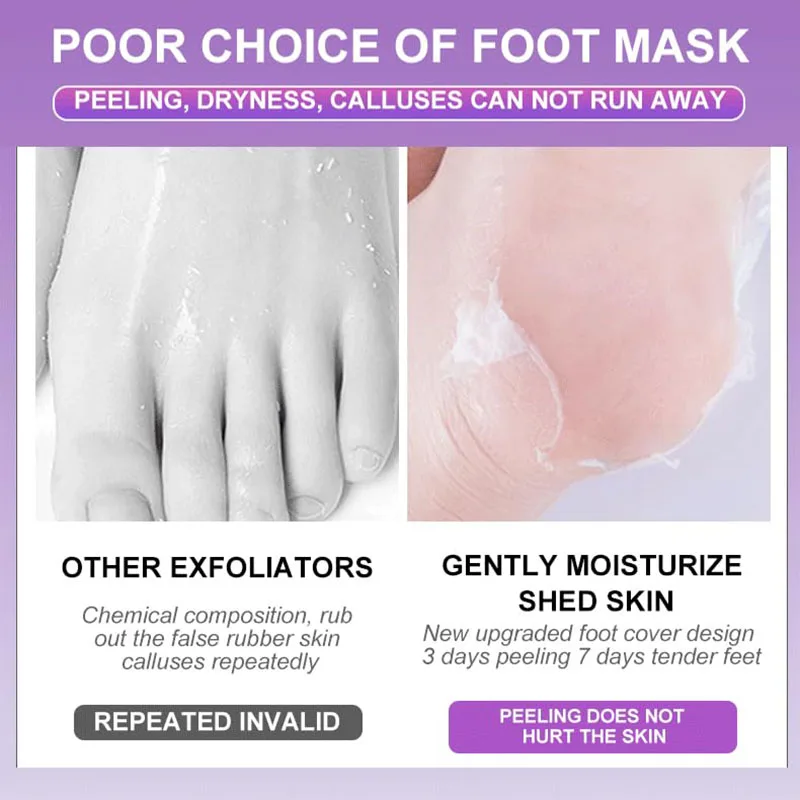Fußpeeling-Maske, 5/10er-Pack, Peeling für Schwielen, natürliches Peeling für trockene abgestorbene Haut, Hornhaut, Reparatur rauer Absatz