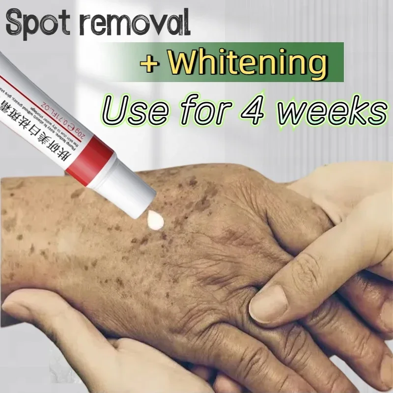 

Whitening Cream for Multiple Parts Dark Spot Remover Women's Hand Freckle Removing Cream Remove Melasma Face Cream Skin Care