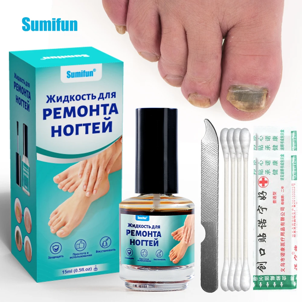 

1/2/3/5/10Pcs Sumifun Onychomycosis Treatment Cream Nail Care Against Fungal Feet Antifungal Anti-Infection Health Care Ointment