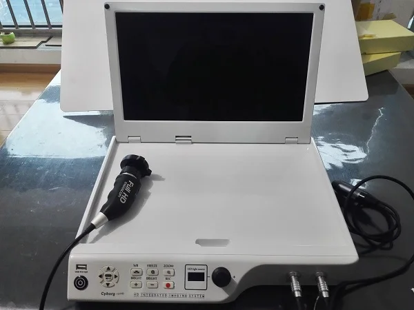 Professinal Surgical New Type CMOS Endoscopy Integrated Sinuscope Camera