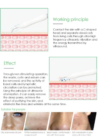 ホログラフィック4ステートの包括的な機器、ディープフェイシャルクリーニング、リフティング、リニア