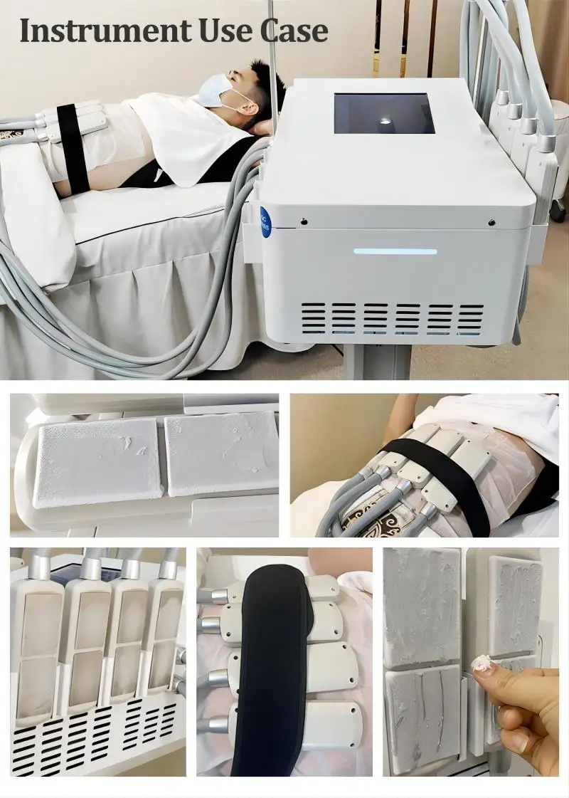 عالية الجودة آلة كريوليبوليسيس العلاج بالتبريد تبريد الجسم نحت الدهون تجميد آلة التخسيس لتخفيف الوزن