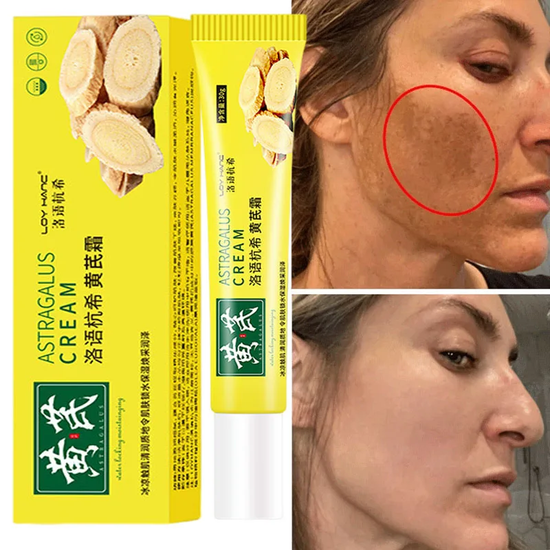 Chinese Astragalus Whitening Freckles Cream Remove Melasma Fade Dark Spots Dark Yellow Skin Brighten Anti-aging Face Skin Care