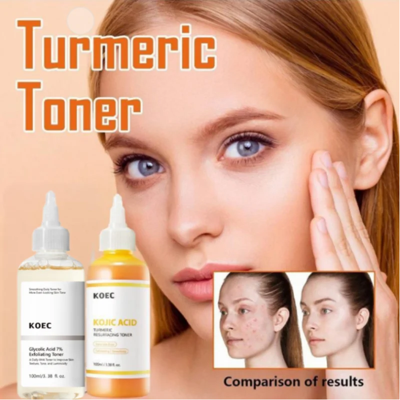 تونر تجديد حمض الكوجيك والكركم 7% تونر تقشير حمض الجليكوليك لتفتيح البشرة وترطيبها حتى نسيج لون البشرة