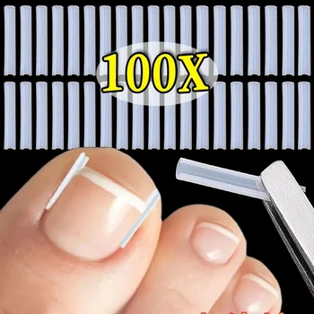 100PCS Unghia del piede incarnita Correttore Tubo Correttore invisibile Punta Toppe elastiche Raddrizzamento Clip Unghia del piede Trattamento Strumento di pedicure