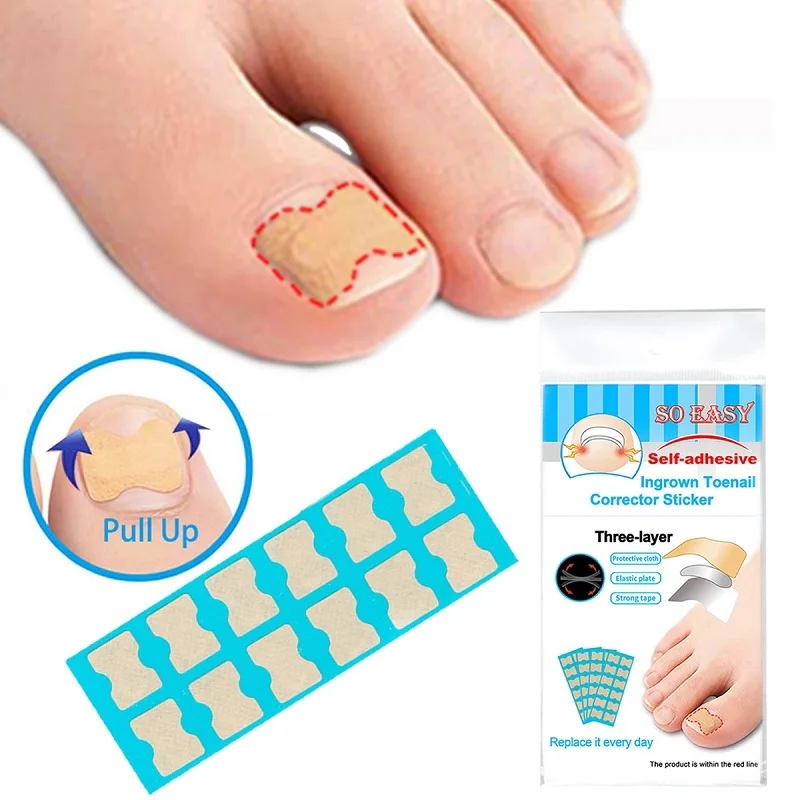 Ingrown Nail Toenail Correction Patch Toenail Corrector Toe Separator Correction Tool Ingrown Toenail Treatment Patch Separators