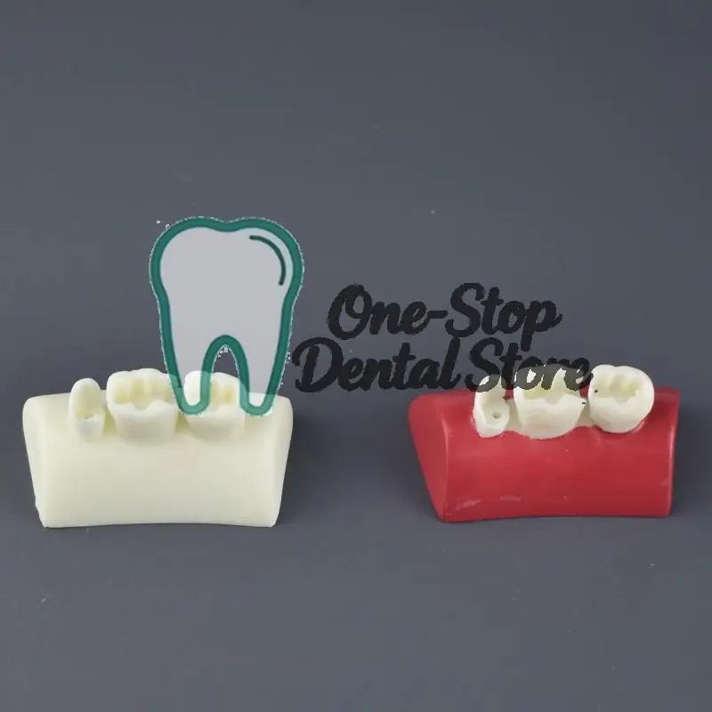 

Dental Inlay Exercise Model Block Filling Practice Typodont Resin for Dentistry Teaching Training Restorative Dental Materials