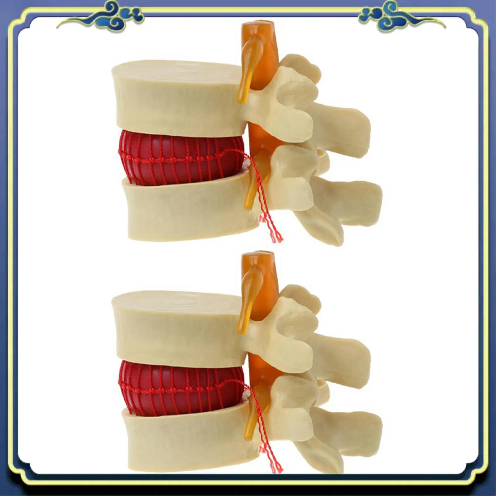 Portable 2X Lumbar Vertebrae Model Anatomical Spine Lumbar Disc Herniation Anatomy Teaching Tool Lumbar Vertebrae Model