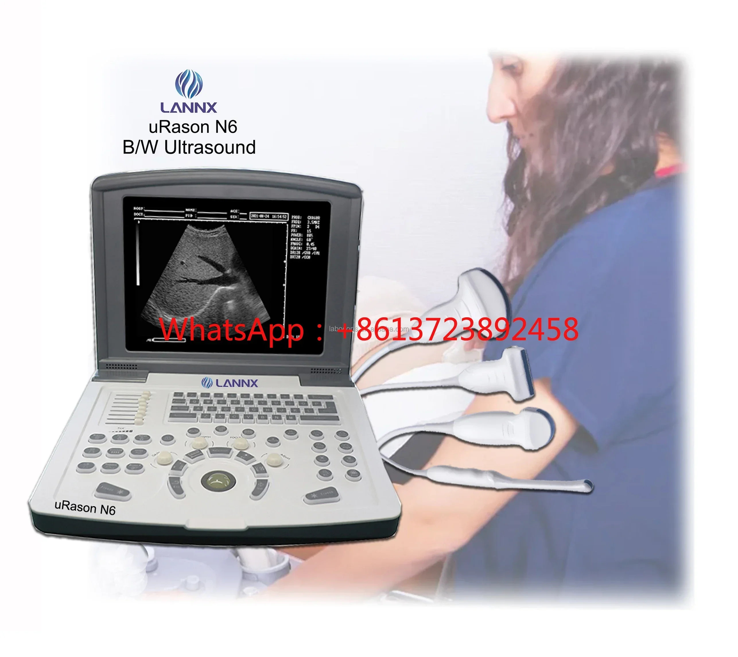 

uRason N6 Customization OB GYN Echocardiography Machine Laptop Portable Ultrasound Scanner ecografo portatil