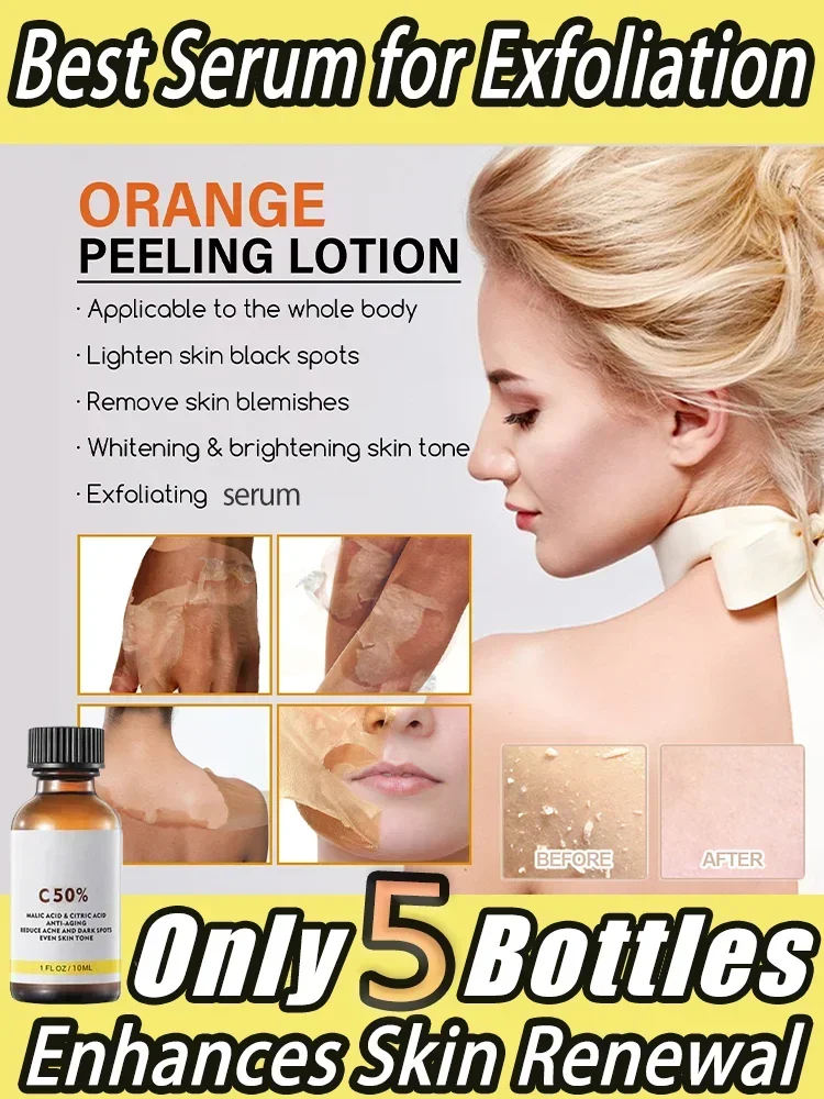 Peeling Serum Bleichen dunkle Haut flecken entfernen abgestorbene Haut Melanin Peeling Peeling Weiß befeuchten die Haut verjüngende Essenz