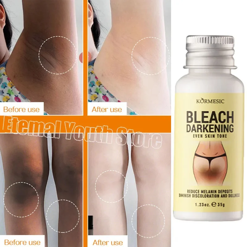 Body Whitening Cream Private Parts Underarm Bleaching Serum Remove Melanin For Dark Skin Body Brighten White Care Products