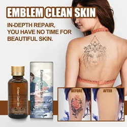 Schnelle Tattoo entfernung Serum permanente Tattoo entferner flüssige natürliche schmerzlose Körper Gesichts pigment verblassende Tattoo Nachsorge creme