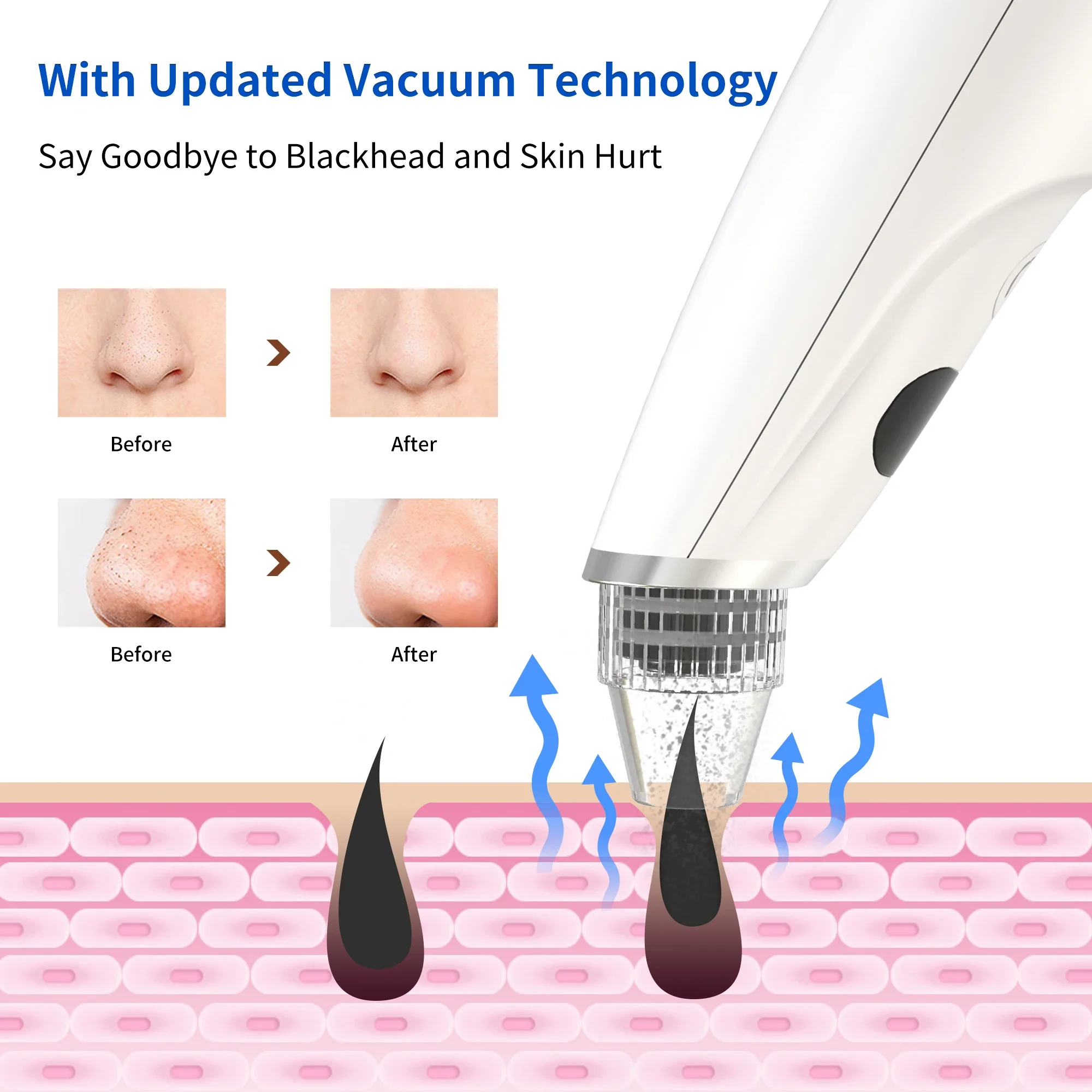Professional Face Cleansing Vacuum Suction Machine Rechargeable Blackhead Pore Vacuum Removal Instrument