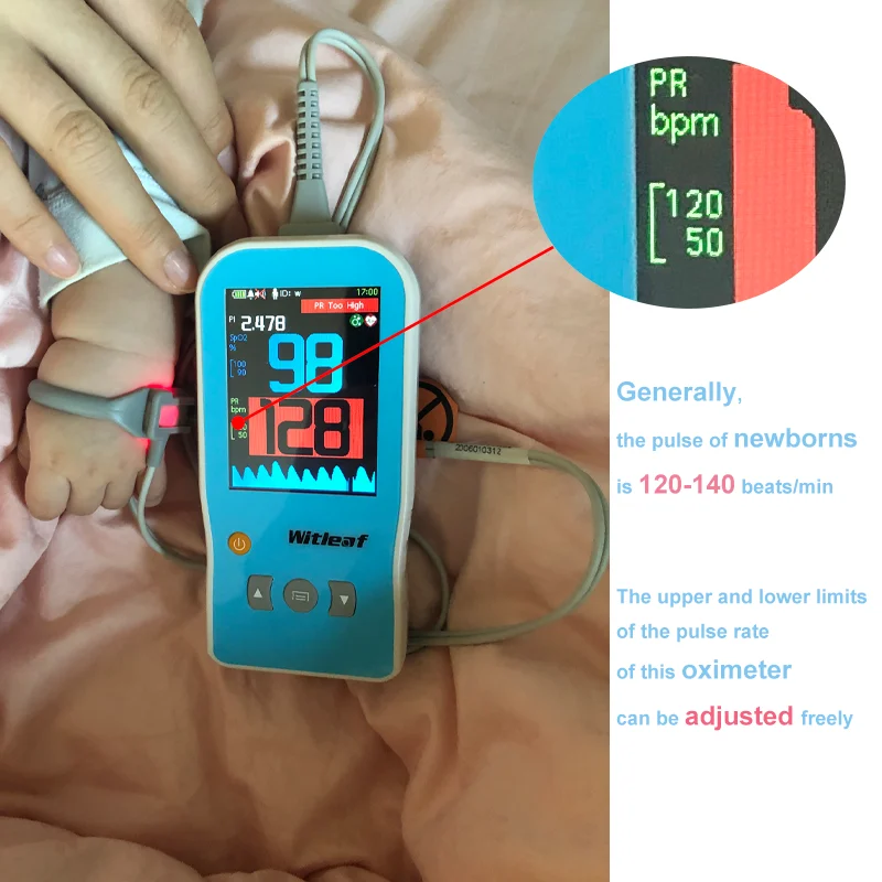 Witleaf Handheld Pulse Oximeter Professional Oximetro Pulso Neonatal Mother Kids Baby Pet Veterinary SPO2 PI PR Cardiac Monitor