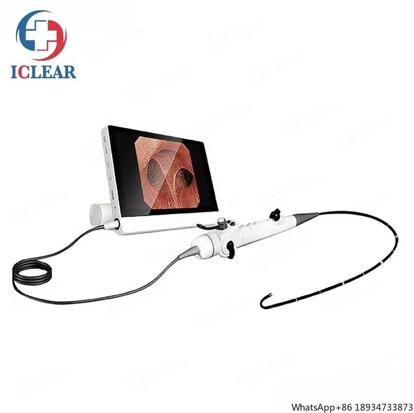 High Quality Medical Electronic Uretero-pyeloscopy Endoscope