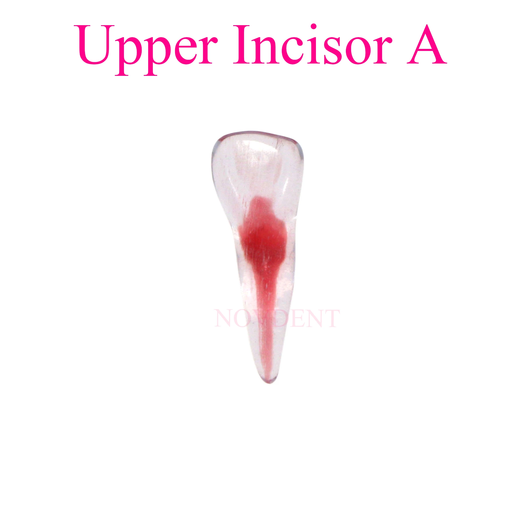 3D Dental Root Canal Model Practice Model Upper Incisor A Root Canal Therapy Resin Model Endodontics RTC