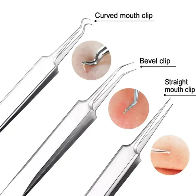 3Pcs Set Stainless Steel Blackhead Removal Tweezers With A Plastic Box High Precision And Durability Blackhead Removal Tweezers`