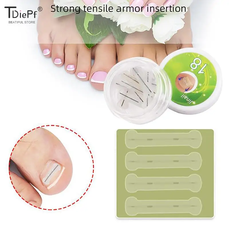 Ingrown Toenail Corrector Tools Pedicure Recover Embed Toe Nail Treatment Professional Ingrown Toenail Correction Foot Care Tool