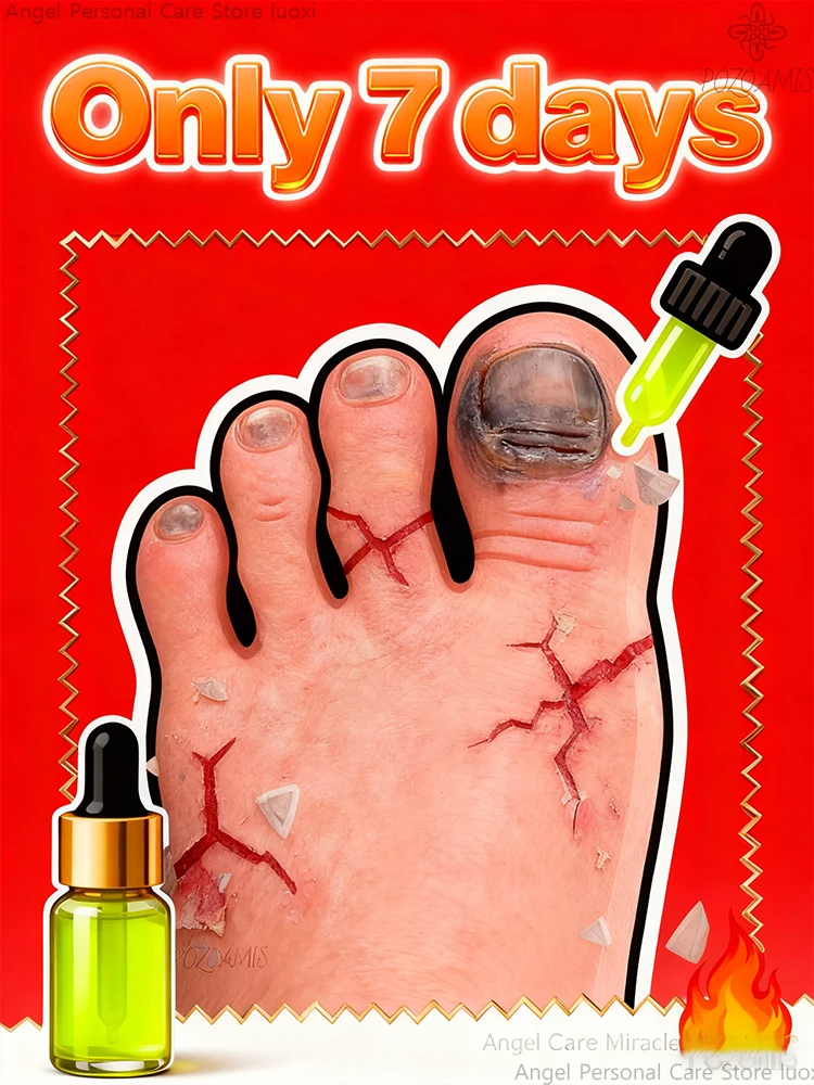 

Научно разработанные, действии напрямую на гвоздушной кровати, объединяют корне причина проблем и способствуют здоровым новым гвоздям.