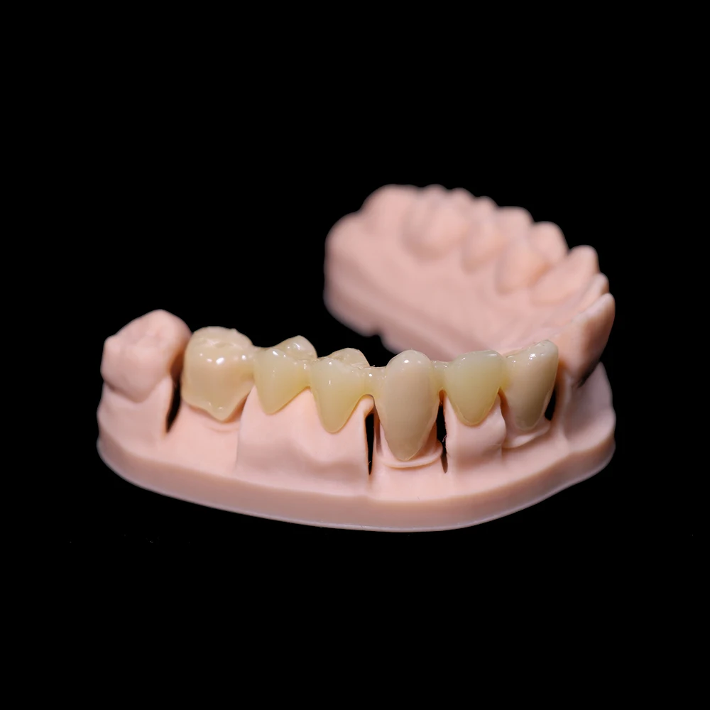 1KG Polyester UV Photopolymer Resin, for Lab Dental Model 3D Printing, Light Curing Material