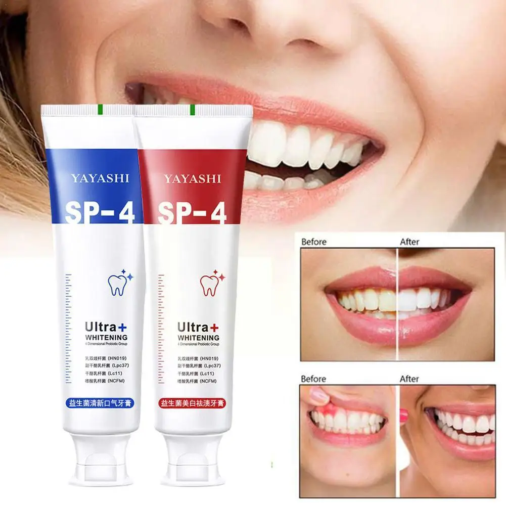 Probiótico Whitening Shark Toothpaste, Placa dos dentes, Previne a respiração fresca, Higiene bucal, 120g, R1Z9