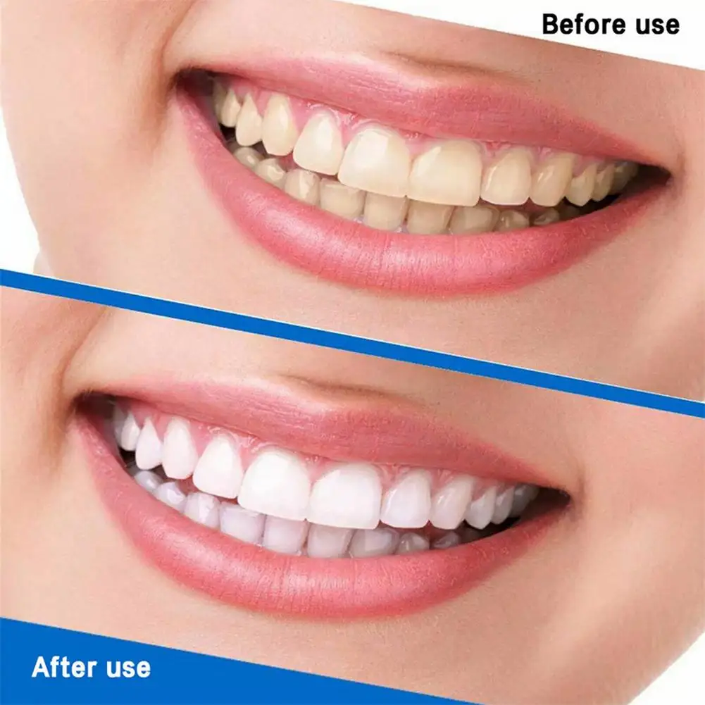 Toothpaste Quick Repair of Cavities Fresh Breath Removal Plaque Repair Teeth Care Product Wholesale Teeth Whitening mouthwash