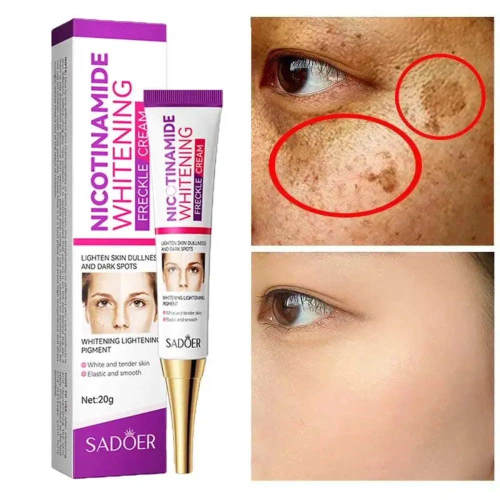 Melasma branqueamento creme para mulheres, nicotinamida, clareamento, hidratar, hidratação da pele, desvanecer-se manchas cor, sardas