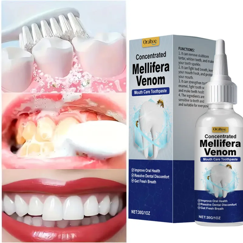 serum-clareador-dental-para-remover-placa-gel-para-dentes-brancos-pasta-de-dente-para-manchas-amarelas-e-de-fumaca-halito-fresco-cuidado-de-higiene-bucal