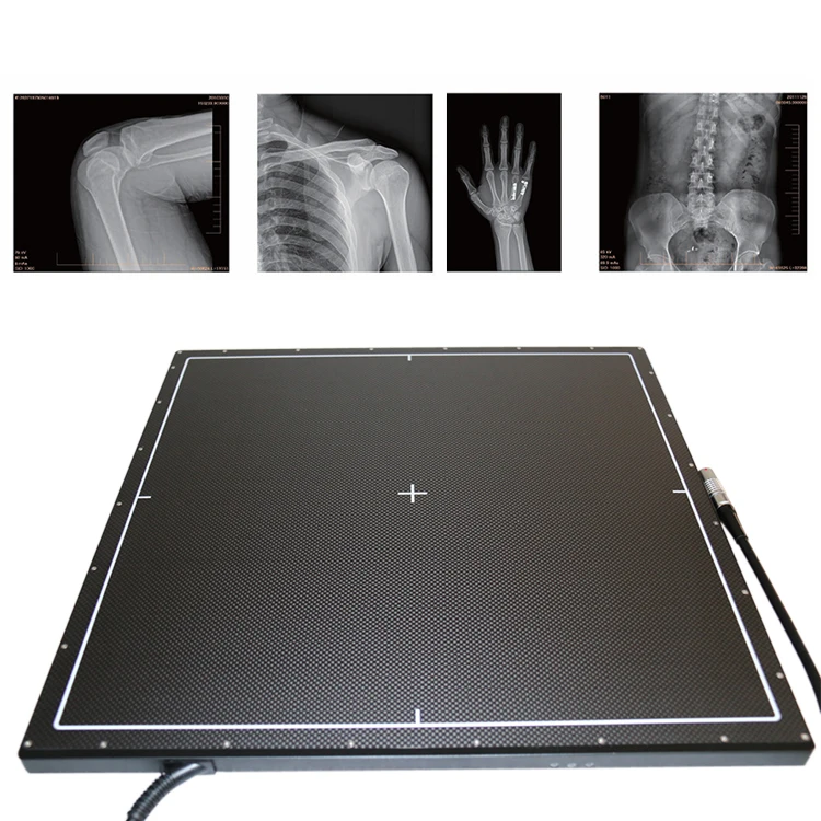 Best Price 17*17 Wireless Portable Flat Panel X Ray Detector Dr Flat Panel Detector Flat Panel Detector Veterinary