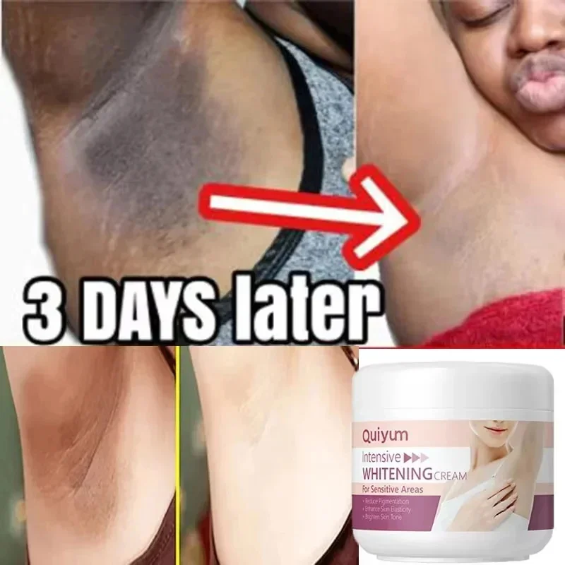 

Body Whitening Cream Private Parts Underarm Whiten Butt Knee Brighten Inner Thigh Intimate Parts Dark Remove Melanin 30g