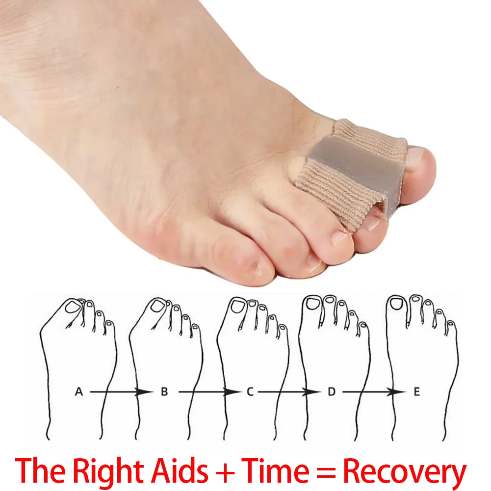 Silicone Toe Spreader Finger Separator Valgus Corrector Thumb Correction Straightener Foot Care Orthopedic image 2