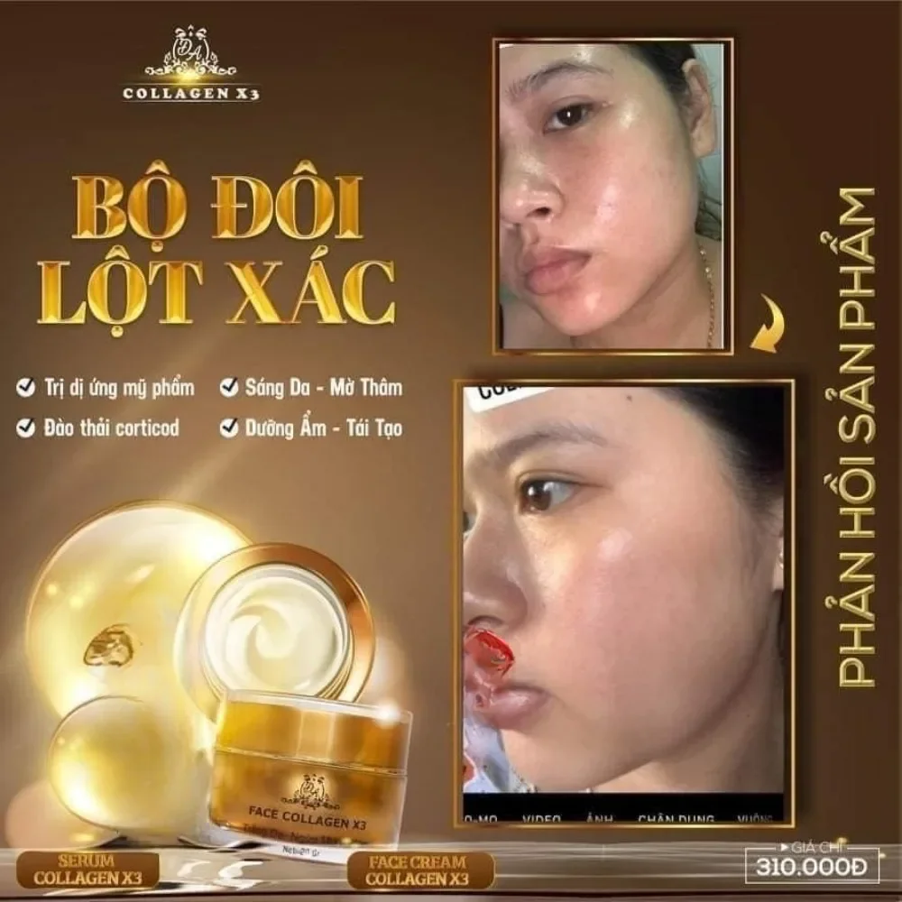 Kem Duong Da Face Colagen X3 WHITENING Skin Care Face Creams for Women